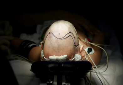 Hospital General CMN La Raza IMSS realiza primera jornada de craneosinotosis en México